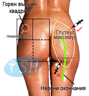 gluteusinjectionshsure